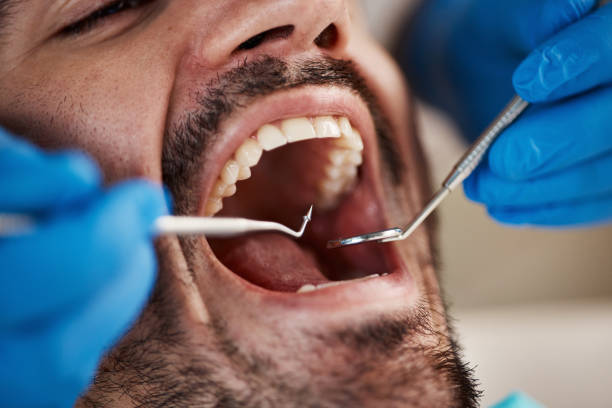 Best Emergency Care for Gum Disease in Bayou Blue, LA